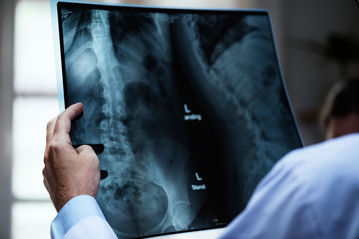 radiografia radiografia